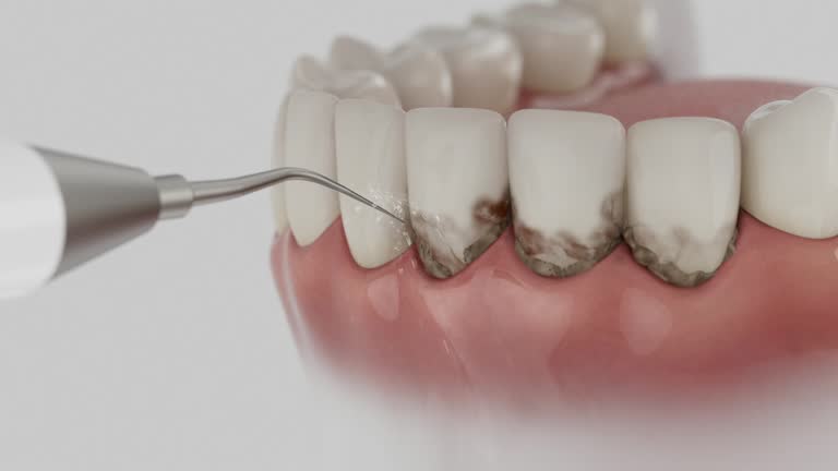 Reliable Dental Implants contractor in Maple Grove, MN by Smile Center Dentistry